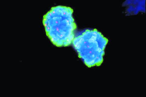DNA-Doppelstrangbrüche während der Zellteilung: Die Aufnahme zeigt zwei sich teilende BRCA2-mutierte Zellen, in denen der alternative Reparaturprozess ausgeschaltet wurde. Die Zellen weisen zahlreiche unreparierte Doppelstrangbrüche auf (erkennbar als rote Punkte in der blauen DNA). Foto: Michael Ensminger