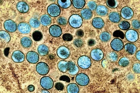 Das Affenpocken-Virus vergrößert unter dem Mikroskop. Foto: dpa