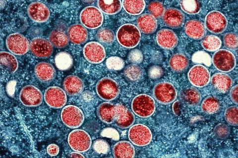 Eine kolorierte transmissionselektronenmikroskopische Aufnahme von Partikeln des Affenpockenvirus (rot) in einer infizierten Zelle (blau), die im Labor gezüchtet und in der NIAID Integrated Research Facility aufgenommen wurde. Foto: Niaid/Niaid/Planet Pix via ZUMA Press Wire/dpa 