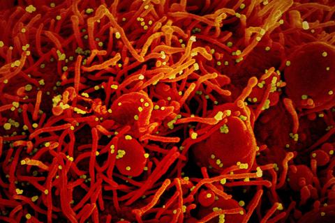 Eine Zelle (rot) mit dem Coronavirus (SARS-CoV-2, gelb) infiziert.  National Institute of Allergy and Infectious Diseases/Europa Press/dpa